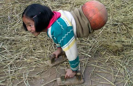 バスケットボールの少女